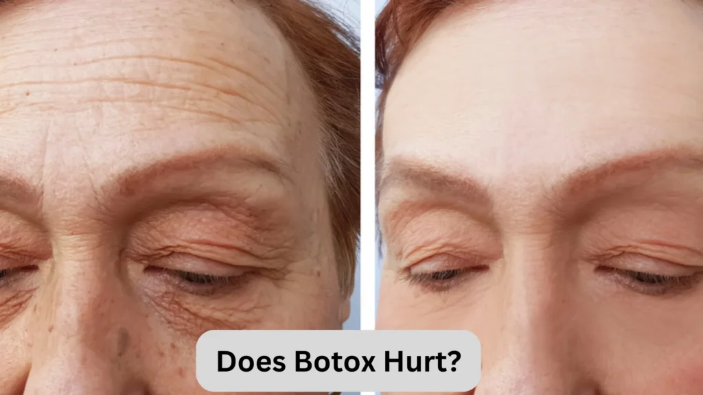 Does Botox Hurt?